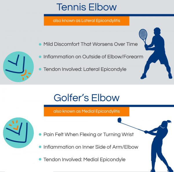 tennis elbow and golfer's elbow