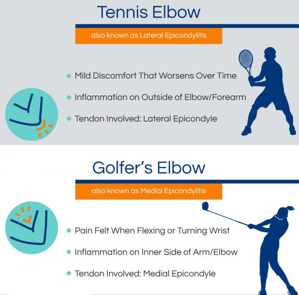 coude du tennis et coude du golfeur