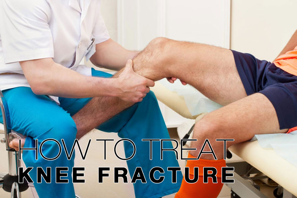 Como tratar a fratura do joelho