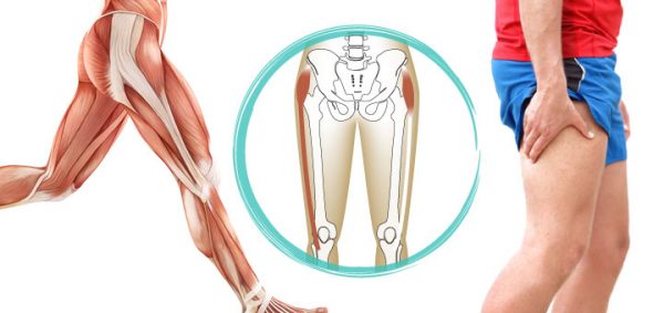 Wie lange dauert das IT-Band-Syndrom?