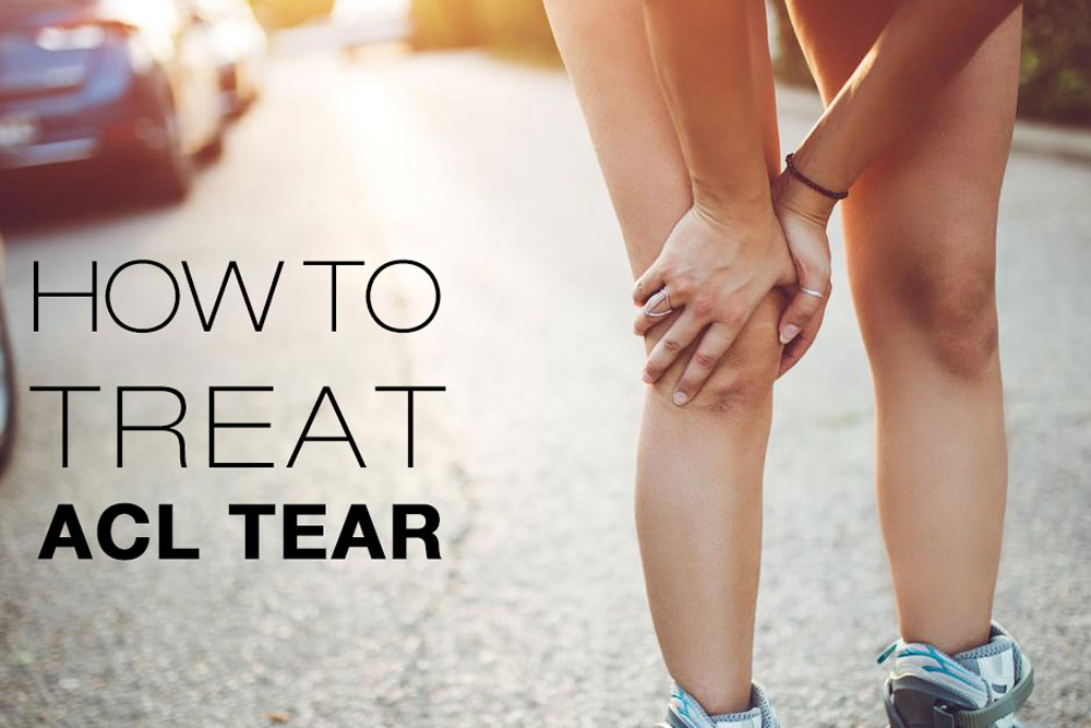 How-to-treat-ACL-tear
