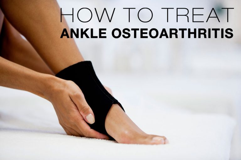 Ankle Osteoarthritis Symptoms, Causes, Treatment By Ankle Braces