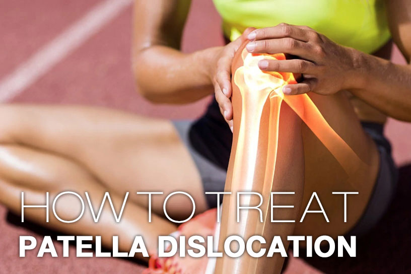 How To treat Patella Dislocation