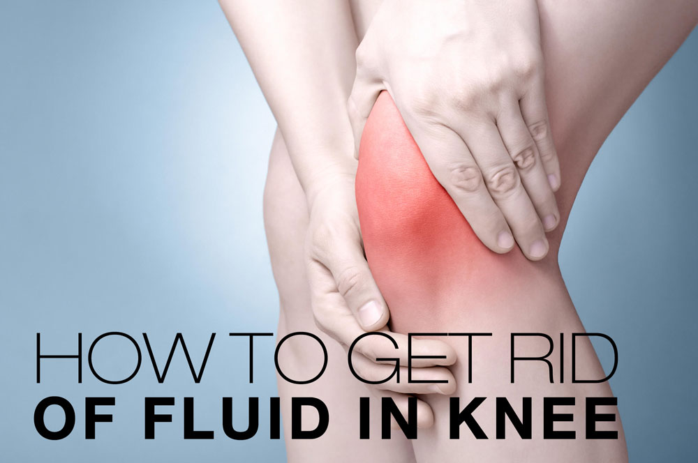 How to Get Rid of Fluid in Knee