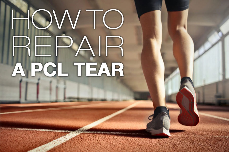 How to repair a PCL tear
