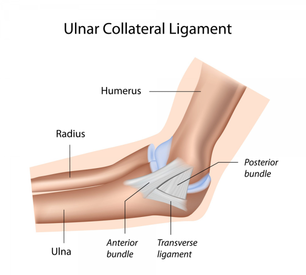 What is Elbow Hyperextension?