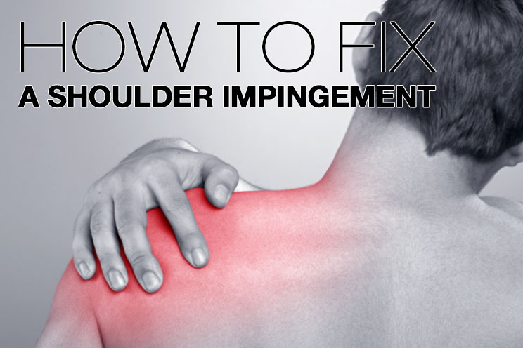 How to Fix a Shoulder Impingement
