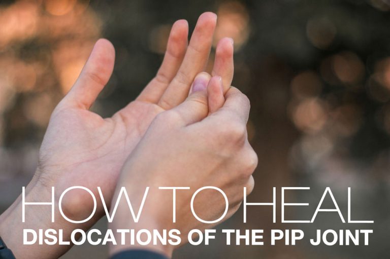 Dislocations Of The PIP Joint Symptoms, Causes, Treatment By Wrist