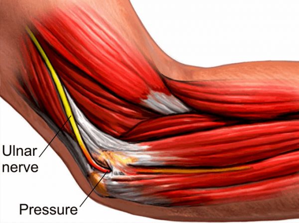 Qu'est-ce qui cause l'irritation du nerf cubital ?