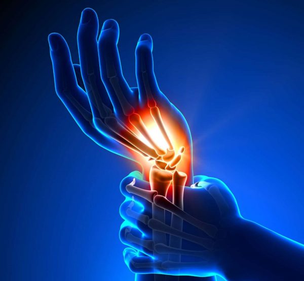 Welche Ursachen und was sind die Symptome einer Handgelenksverstauchung?