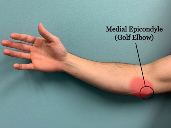 What causes Golfer's Elbow?