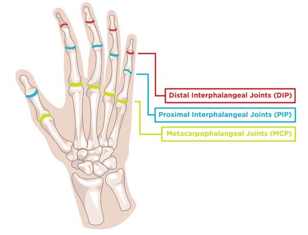 ما هو Jammed Thumb