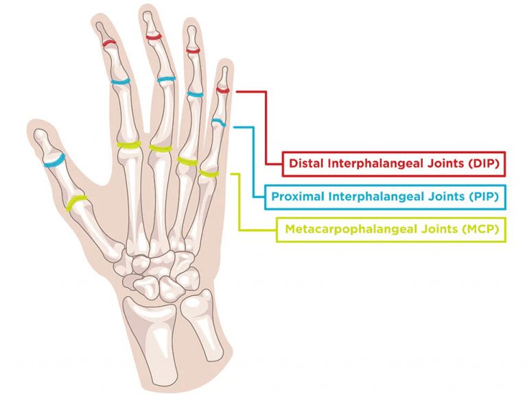 Jammed Thumb Symptoms, Causes, Treatment By WristT & Thumb Braces