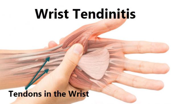 tendons in the wrist