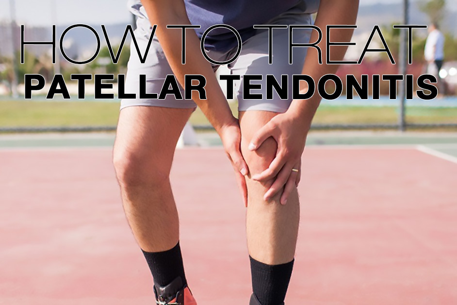 Tirantes para el tratamiento de la tendinitis rotuliana