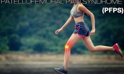 Patellofemoral Pain Syndrome Knee Braces