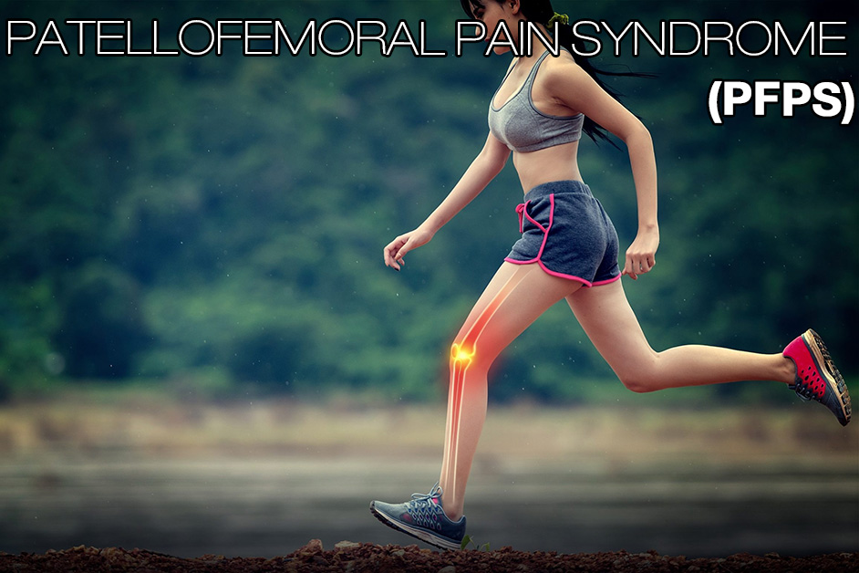 Patellofemoral Pain Syndrome Knee Braces