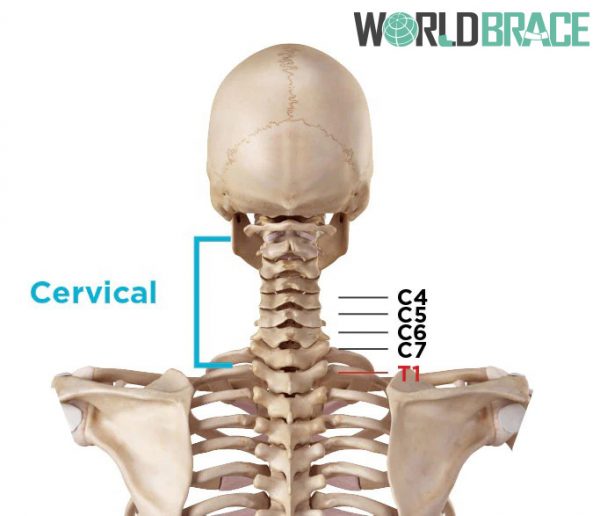 Ubicación de la estenosis espinal cervical