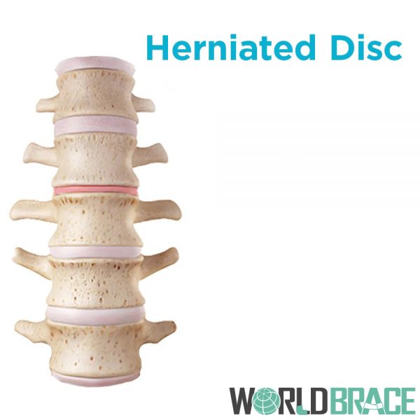 help-herniated-disc-pain-in-back
