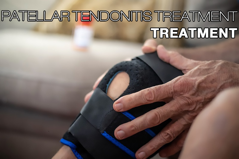 Patellar Tendonitis Treatment Braces