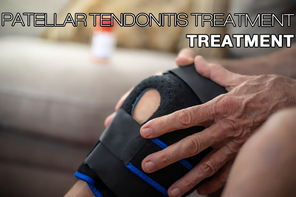 Tirantes para el tratamiento de la tendinitis rotuliana