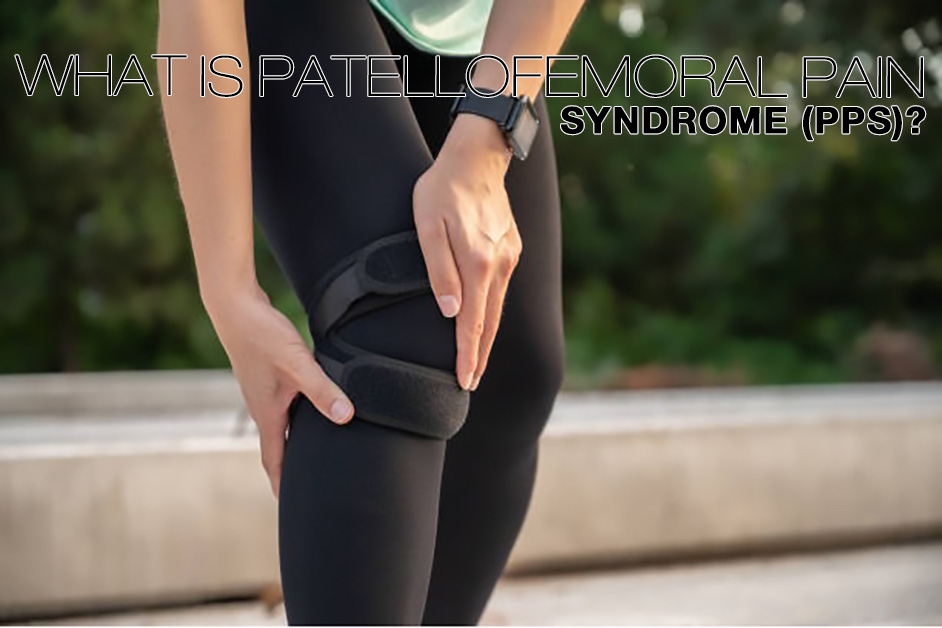 Orthèses de genou pour le syndrome de la douleur fémoro-patellaire