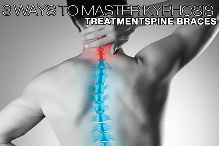 3 Ways To Master KYPHOSIS TREATMENTSPINE BRACES WorldBrace