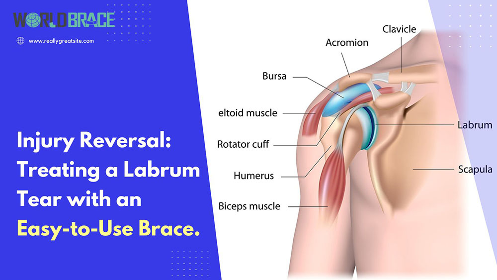 Orthèse d'épaule pour déchirure du Labrum